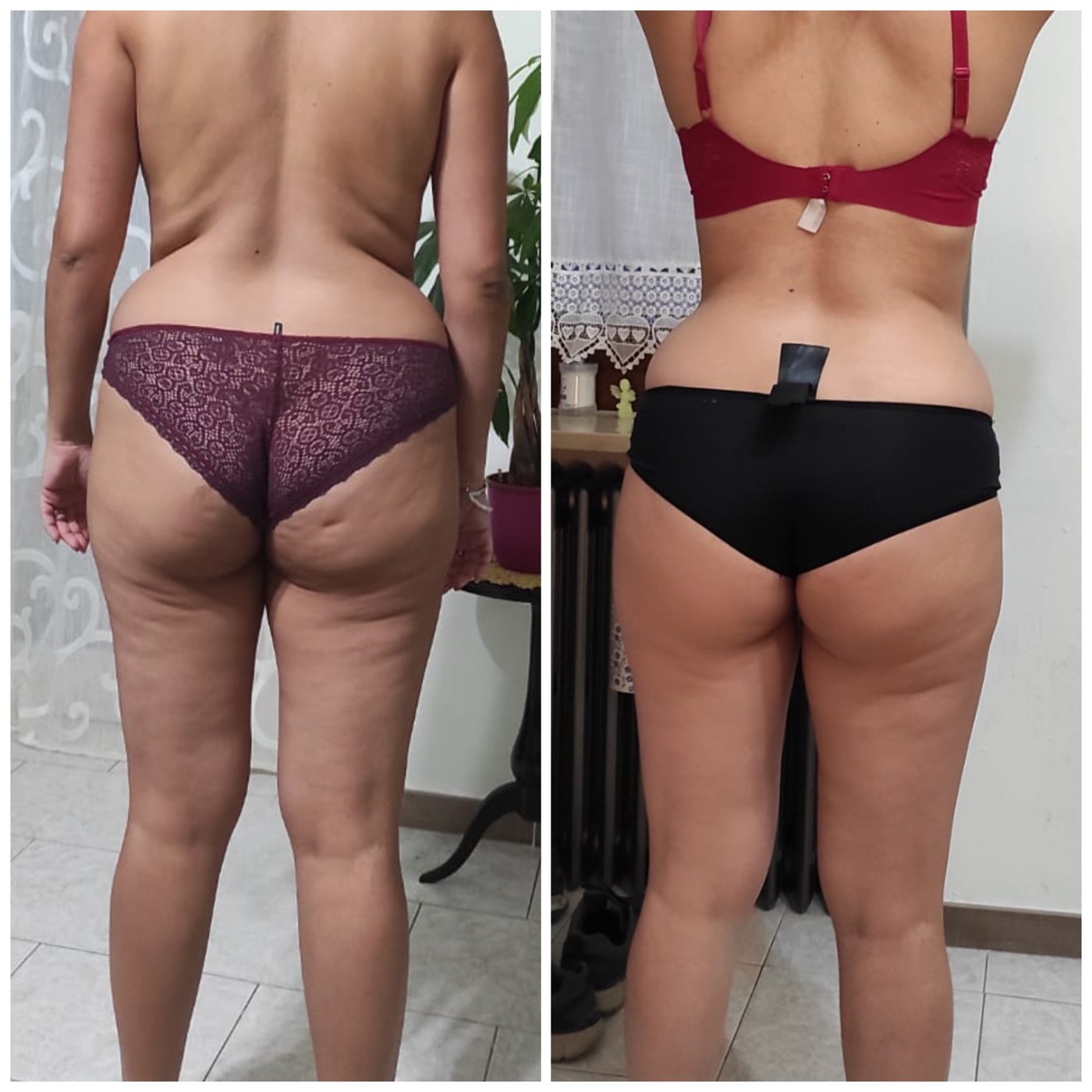 Giorgia C — prima e dopo