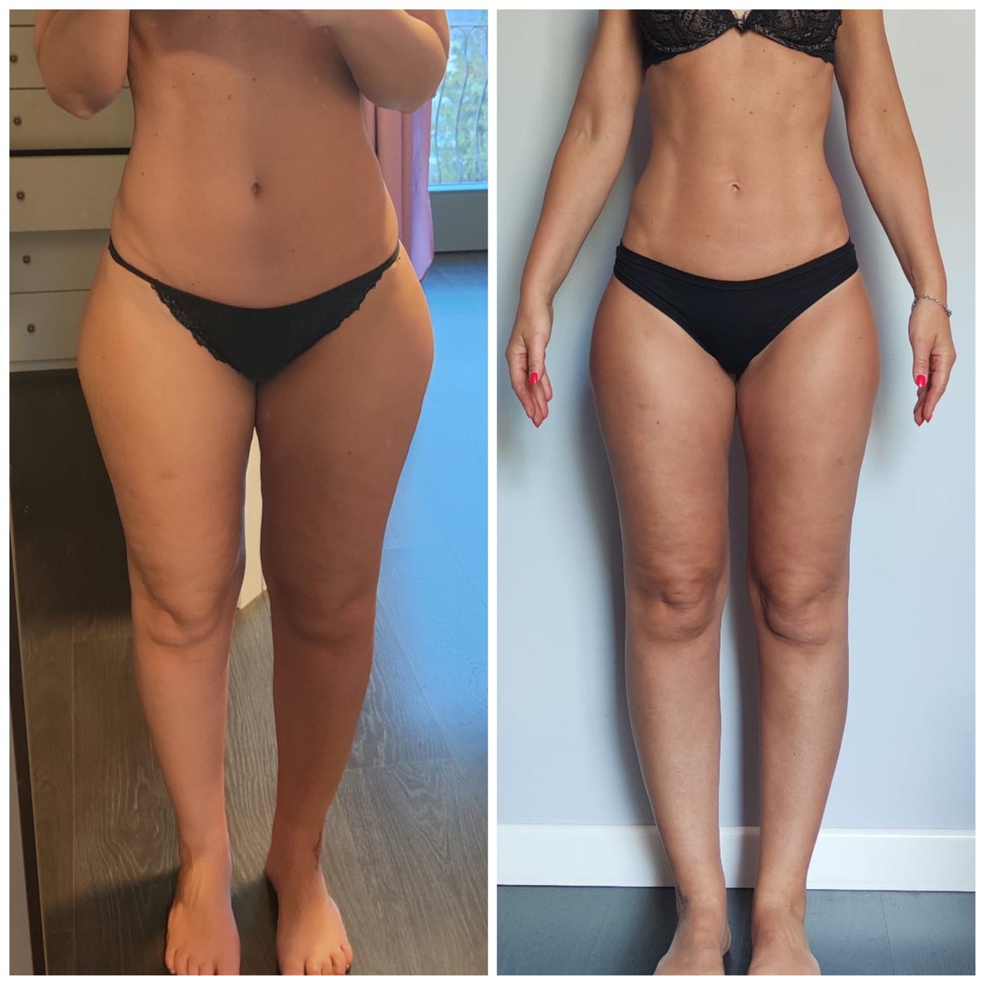 Martina C — prima e dopo