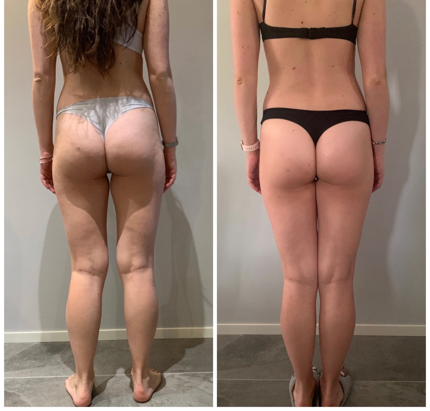 Francesca. B — prima e dopo