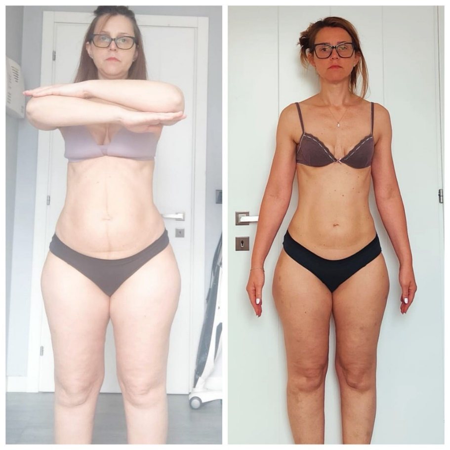 Liana. F — prima e dopo