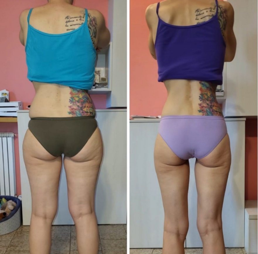 Fabrizia — prima e dopo